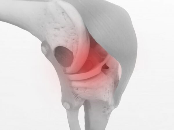 膝の靭帯損傷からの復活ストーリー：痛みから健康への道のり